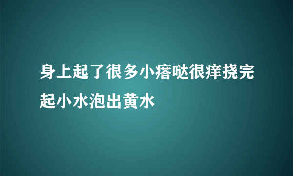 身上起了很多小瘩哒很痒挠完起小水泡出黄水