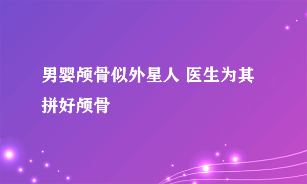 男婴颅骨似外星人 医生为其拼好颅骨