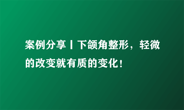 案例分享丨下颌角整形，轻微的改变就有质的变化！