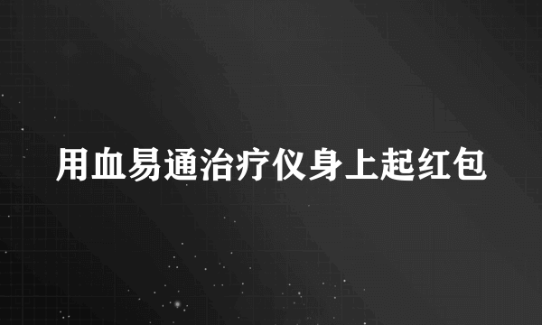 用血易通治疗仪身上起红包