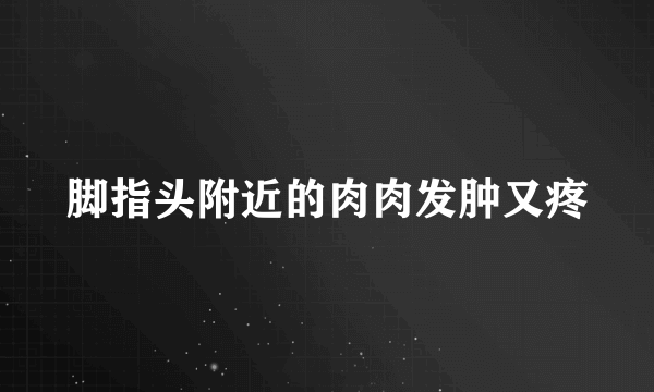 脚指头附近的肉肉发肿又疼