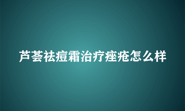 芦荟祛痘霜治疗痤疮怎么样