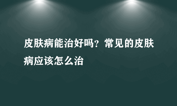 皮肤病能治好吗？常见的皮肤病应该怎么治