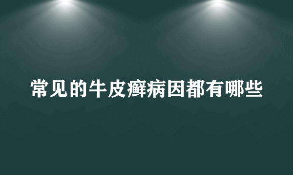 常见的牛皮癣病因都有哪些