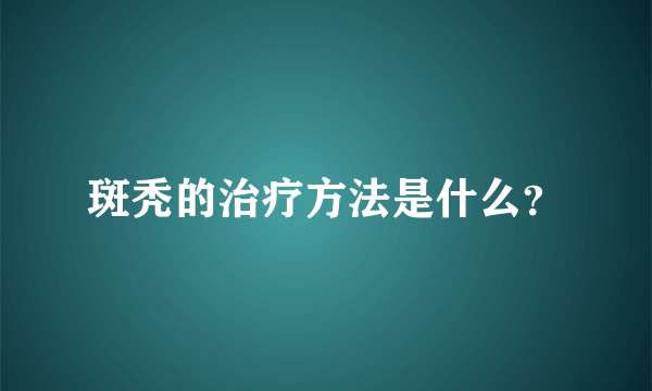 斑秃的治疗方法是什么？