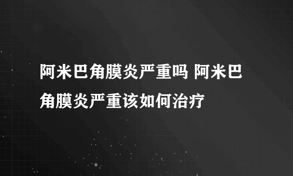 阿米巴角膜炎严重吗 阿米巴角膜炎严重该如何治疗