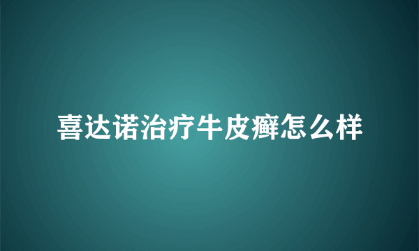 喜达诺治疗牛皮癣怎么样