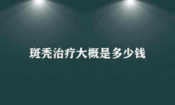 斑秃治疗大概是多少钱