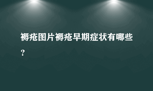 褥疮图片褥疮早期症状有哪些？