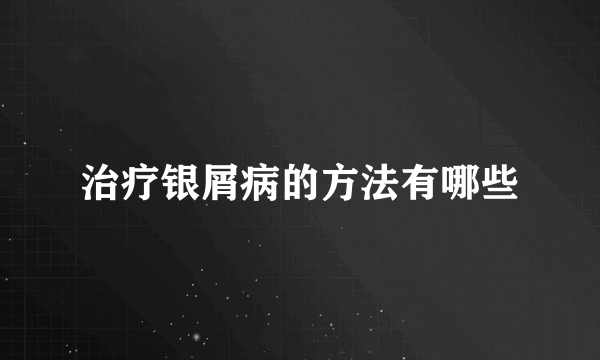 治疗银屑病的方法有哪些