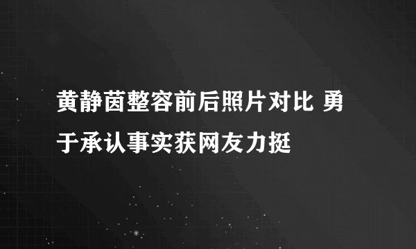 黄静茵整容前后照片对比 勇于承认事实获网友力挺