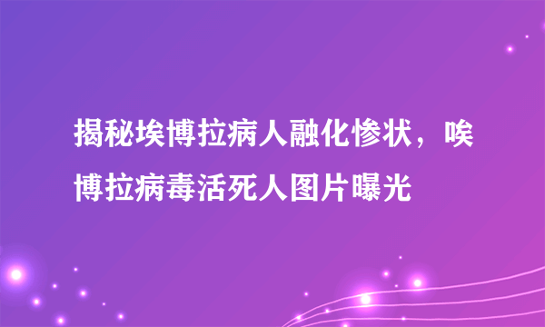 揭秘埃博拉病人融化惨状，唉博拉病毒活死人图片曝光