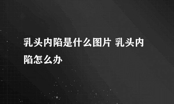 乳头内陷是什么图片 乳头内陷怎么办