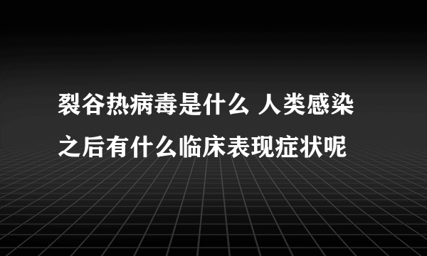 裂谷热病毒是什么 人类感染之后有什么临床表现症状呢