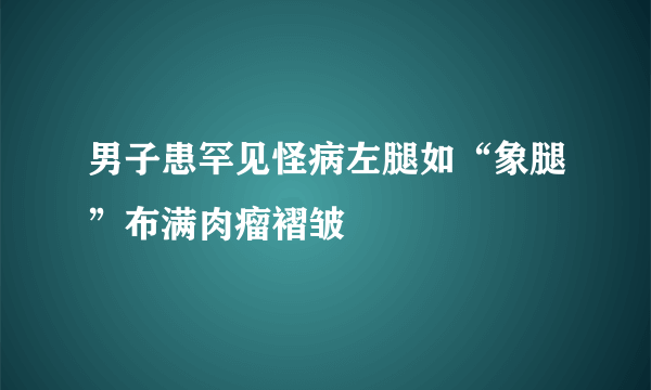 男子患罕见怪病左腿如“象腿”布满肉瘤褶皱