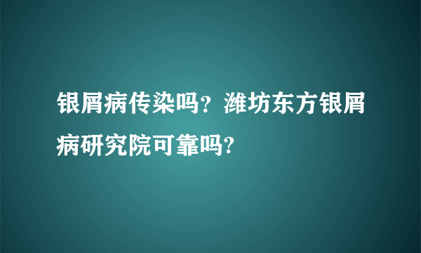 银屑病传染吗？潍坊东方银屑病研究院可靠吗?