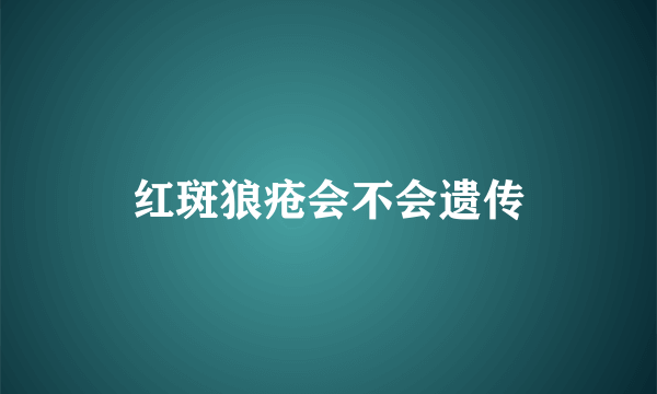 红斑狼疮会不会遗传