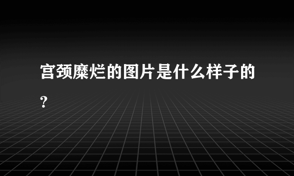 宫颈糜烂的图片是什么样子的？