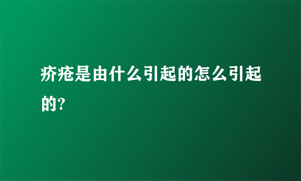 疥疮是由什么引起的怎么引起的?