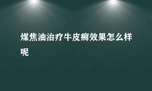 煤焦油治疗牛皮癣效果怎么样呢