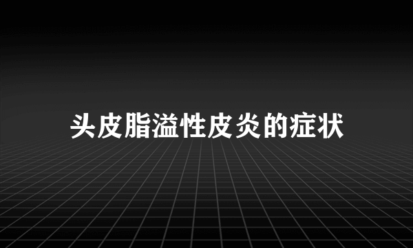 头皮脂溢性皮炎的症状