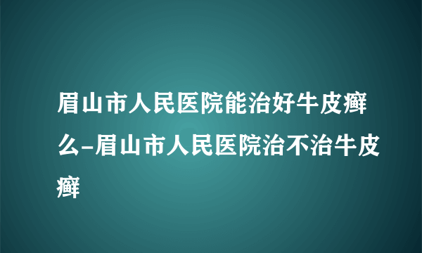 眉山市人民医院能治好牛皮癣么-眉山市人民医院治不治牛皮癣