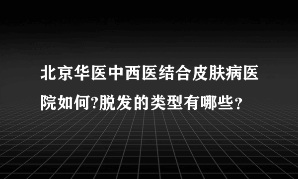 北京华医中西医结合皮肤病医院如何?脱发的类型有哪些？