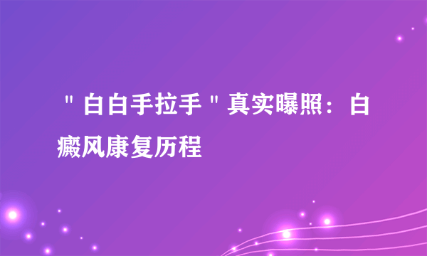 ＂白白手拉手＂真实曝照：白癜风康复历程