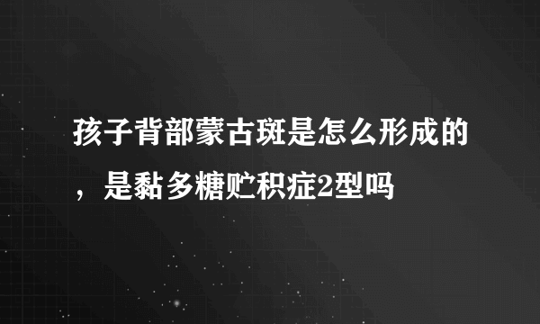 孩子背部蒙古斑是怎么形成的，是黏多糖贮积症2型吗