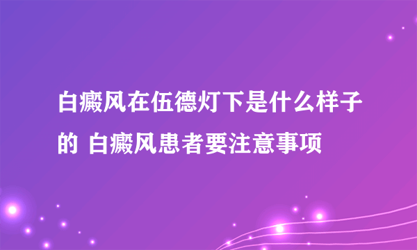 白癜风在伍德灯下是什么样子的 白癜风患者要注意事项