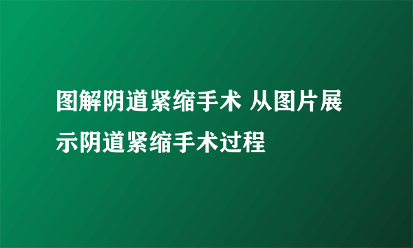 图解阴道紧缩手术 从图片展示阴道紧缩手术过程