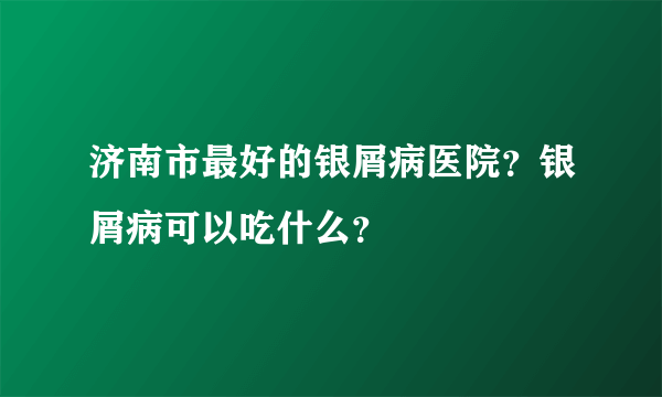 济南市最好的银屑病医院？银屑病可以吃什么？