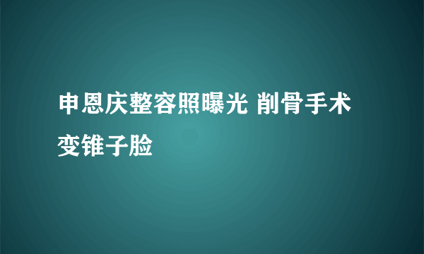 申恩庆整容照曝光 削骨手术变锥子脸