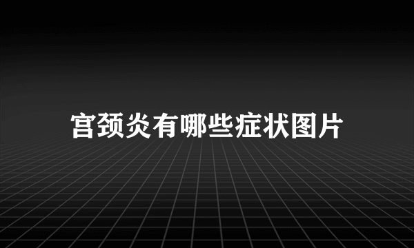 宫颈炎有哪些症状图片