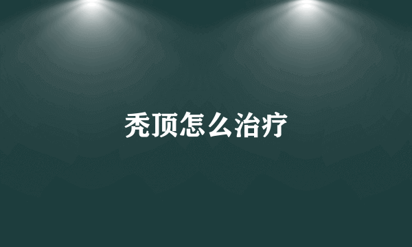 秃顶怎么治疗