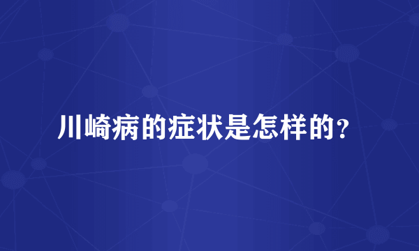 川崎病的症状是怎样的？