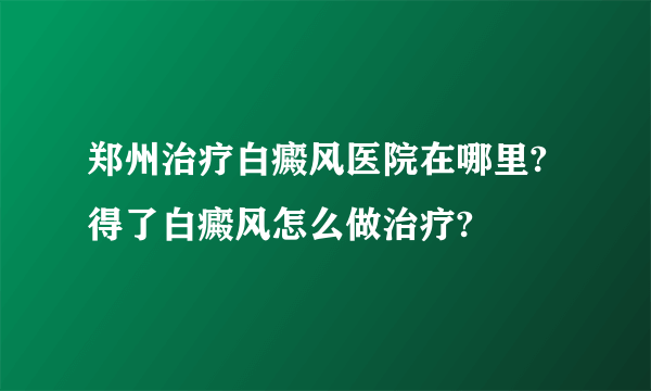 郑州治疗白癜风医院在哪里?得了白癜风怎么做治疗?