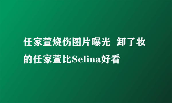 任家萱烧伤图片曝光  卸了妆的任家萱比Selina好看