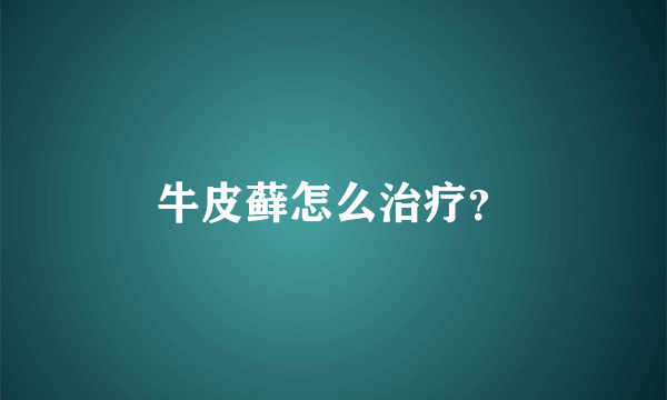 牛皮藓怎么治疗？