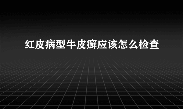 红皮病型牛皮癣应该怎么检查