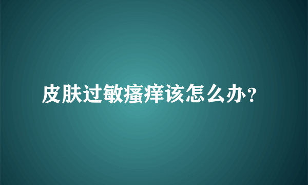 皮肤过敏瘙痒该怎么办？