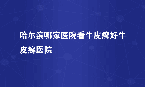 哈尔滨哪家医院看牛皮癣好牛皮癣医院