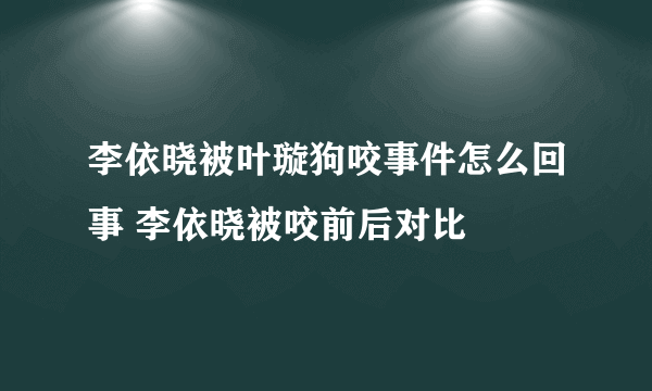 李依晓被叶璇狗咬事件怎么回事 李依晓被咬前后对比