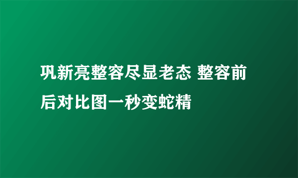 巩新亮整容尽显老态 整容前后对比图一秒变蛇精