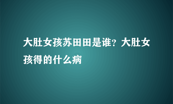 大肚女孩苏田田是谁？大肚女孩得的什么病