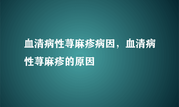 血清病性荨麻疹病因，血清病性荨麻疹的原因