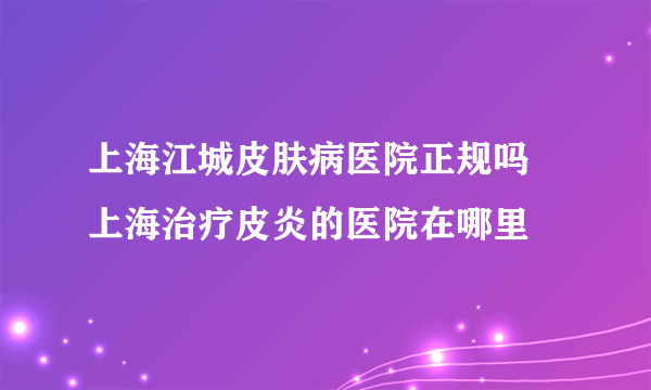 上海江城皮肤病医院正规吗 上海治疗皮炎的医院在哪里