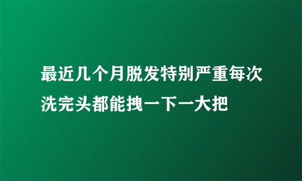 最近几个月脱发特别严重每次洗完头都能拽一下一大把