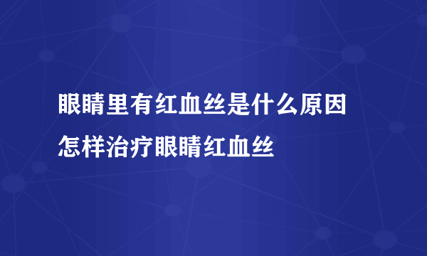 眼睛里有红血丝是什么原因 怎样治疗眼睛红血丝