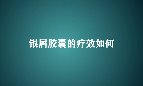 银屑胶囊的疗效如何